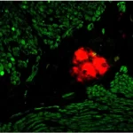 Small Bowel (Frozen, Double Label): Pgp9.5 (M), Mom Basic Kit, Vectastain Abc Ap Standard Kit, Vector Red Substrate (Red); Desmin (M), Mom Fluorescein Kit (Green).