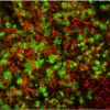 Tonsil (frozen, double label): Ki67 (m), MOM Fluorescein Kit (green); Pan-Cytokeratin (m), MOM Basic Kit, Texas Red Avidin DCS (red).