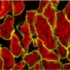 Skeletal Muscle (frozen, unfixed; double label): Alpha-sarcoglycan (m), MOM Fluorescein Kit (green); Muscle Specific Actin (M), MOM basic Kit, Texas Red Avidin DCS (red).