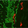 Colon (frozen, double label): Desmin (m), MOM Fluorescein Kit (green); Peripherin (m), MOM Basic Kit, Texas Red Avidin DCS (red).