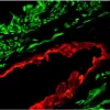 Prostate (frozen, double label): Muscle Specific Actin (m), MOM Fluorescein Kit (green); Multi-Cytokeratin (m), MOM Basic Kit, Texas Red Avidin DCS (red).