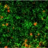 Tonsil (frozen, double label): Ki67 (m), MOM Basic Kit, Texas Red Avidin DCS (red); CD20 (m), MOM Fluorescein Kit (green).