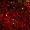 Tonsil (frozen, double label): Ki67 (m), MOM Fluorescein Kit (green); CD20 (m), MOM Basic Kit, Texas Red Avidin DCS.