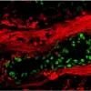 Tonsil (frozen, double label): p63 (m), MOM Fluorescein Kit (green); Multi-Cytokeratin (m), MOM Basic Kit, Texas Red Avidin DCS (red).