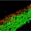 Tonsil (frozen, double label): p63 (m), MOM Basic Kit, Texas Red Avidin DCS (red); Multi-Cytokeratin (m), MOM Fluorescein Kit (green).