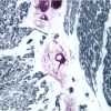Small bowel (double label): Neurofilament 200kD (m), ImmPRESS Anti-Mouse Ig Reagent, Vector VIP substrate (purple); Desmin (m), ImmPRESS Anti-Mouse Ig Reagent, Vector SG substrate (blue/gray).