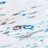 Colon (double label): M2A Antigen (m), ImmPRESS Universal Reagent, Vector NovaRED substrate (red); CD34 (m), VECTASTAIN Universal ABC-AP Kit, Vector Blue substrate (blue).