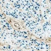 Endometrium (double label): Progesterone Receptor (rm), VECTASTAIN Universal ABC-AP Kit, Vector Blue substrate (blue); CD34 (m), VECTASTAIN Universal Elite ABC Kit, DAB substrate (brown).