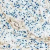 Endometrium (double label): Progesterone Receptor (rm), VECTASTAIN Universal ABC-AP Kit, Vector Blue substrate (blue); CD34 (m), VECTASTAIN Universal Elite ABC Kit, DAB substrate (brown).