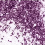 Human Tonsil (Ffpe): Cd45 (Rat) Detected With Immpress Goat Anti Rat Igg And Immpact Vip (Purple). No Counterstain.