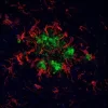 Alzheimer's disease mouse brain model - double label: glial cells stained with Iba1 (rp) followed by DyLight 594 Goat Anti-Rabbit IgG (DI-1594); plaques stained with Biotinylated Mouse Anti-Human Amyloid Beta followed by DyLight 488 Streptavidin (SA-5488)