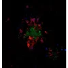 Alzheimer's disease mouse brain model - double label: glial cells stained with Iba1 (rp) followed by DyLight 594 Goat Anti-Rabbit IgG (DI-1594); plaques stained with Biotinylated Mouse Anti-Human Amyloid Beta followed by DyLight 488 Streptavidin (SA-5488)
