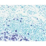 Tonsil Section Showing Specific Cell Staining (Purple, Vector Vip) With Vector Methyl Green (Green) Counterstain.
