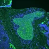 Vector® TrueVIEW® Autofluorescence Quenching Kit with DAPI