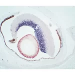 Mouse, Newborn (Eye, Double Label): Gfap (M), Mom Peroxidase Kit, Vector Novared Substrate (Red); Synapsin (M), Mom Peroxidase Kit, Dab+Ni Substrate (Gray/Black). Note Contrast With Endogenous Pigment (Brown) Seen In Surrounding Tissues.