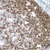 Tonsil: Ki67 antigen detected using ImmPRESS Universal Reagent and Vector DAB (brown) substrate. Hematoxylin QS (blue) counterstain.