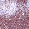 Tonsil: CD3 antigen detected using ImmPRESS Universal Reagent and Vector NovaRED (red) substrate. Hematoxylin QS (blue) counterstain.