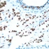 Breast: Estrogen Receptor (m), ImmPRESS Anti-Mouse Ig Kit, DAB Substrate Kit (brown). Hematoxylin counterstain (blue).