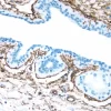 Breast: Estrogen Receptor (m), ImmPRESS Anti-Mouse Ig Kit, DAB Substrate Kit (brown). Hematoxylin counterstain (blue).