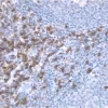 Tonsil: CD8 (m), ImmPRESS Anti-Mouse Ig Kit, DAB Substrate Kit (brown). Hematoxylin QS counterstain (blue).