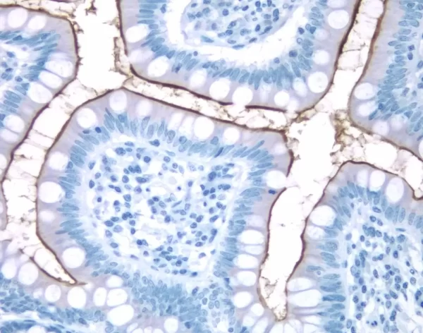 Small Bowel: Cd10 (M), Immpress Anti-Mouse Ig Kit, Dab Substrate Kit (Brown). Hematoxylin Qs Counterstain (Blue).