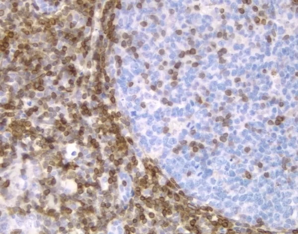 Tonsil: Bcl-2 (M), Immpress Anti-Mouse Ig Kit, Dab Substrate Kit (Brown). Hematoxylin Qs Counterstain (Blue).