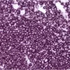Tonsil: CD20 (m), ImmPRESS Anti-Mouse Ig Kit, ImmPACT VIP (purple) substrate.