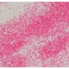 Tonsil: Anti-CD3 (rat monoclonal), ImmPRESS-AP Anti-Rat IgG, Vector Red Substrate.