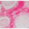 Tonsil: Anti-CD3 (rat monoclonal), ImmPRESS-AP Anti-Rat IgG, Vector Red Substrate.