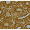 Colon Cancer: anti-Cox2 (rabbit MAb), ImmPRESS HRP Anti-Rabbit IgG (made in goat), DAB Substrate Kit (brown).