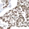 Breast: p53 (rp), ImmPRESS Anti-Rabbit Ig Kit, DAB Substrate Kit (brown). Hematoxylin QS counterstain (blue).