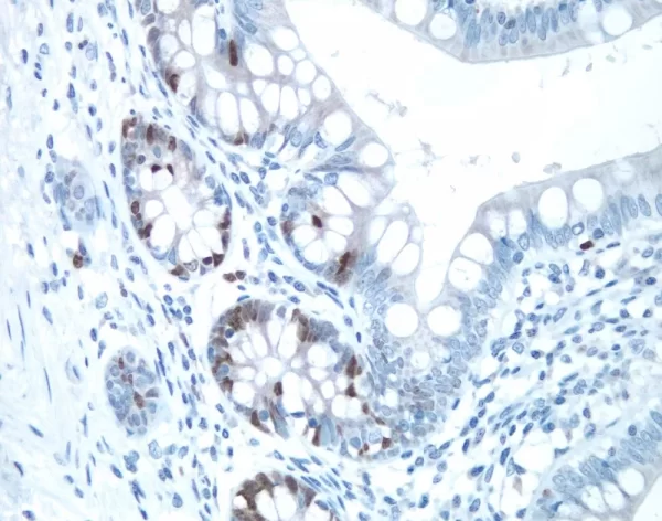 Small Bowel: Ki67 Antigen Stained Using Vectastain Elite Abc Kit And Vector Dab (Brown) Substrate. Hematoxylin Qs (Blue) Counterstain.
