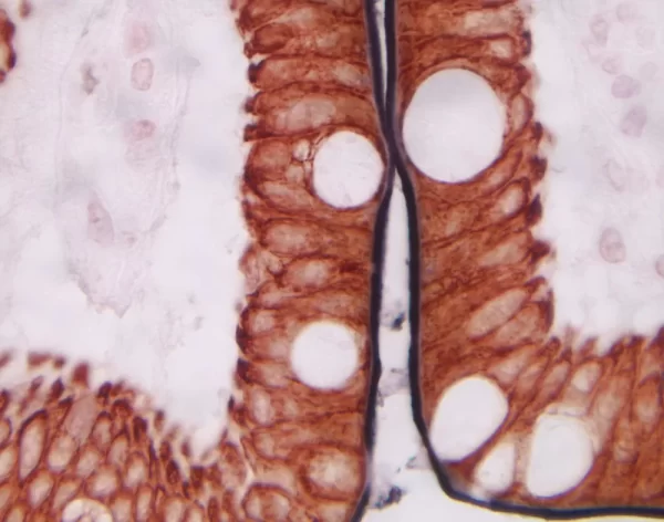 Small Intestine (Double Label): Immpress Anti-Mouse Ig Using Cd10 Primary Antibody With Dab/Ni (Black) Substrate, And Immpress Anti-Mouse Ig Using Cytokeratin 20 Primary Antibody With Vector Novared (Red) Substrate. No Counterstain.