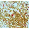Tonsil (paraffin): ImmPRESS Duet Kit (MP-7724) used to detect mouse anti- CD34 (ImmPACT DAB, brown) and rabbit anti-CD3 (ImmPACT Vector® Red, magenta) antibodies.