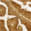 Prostate: Prostate Specific Antigen (m), ImmPRESS Reagent (HRP), ImmPACT DAB (brown).