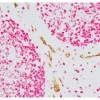 Tonsil (paraffin): ImmPRESS Duet Kit (MP-7724) used to detect mouse anti- CD34 (ImmPACT DAB, brown) and rabbit anti-Ki67 (ImmPACT Vector® Red, magenta) antibodies.