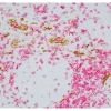Tonsil (paraffin): ImmPRESS Duet Kit (MP-7724) used to detect mouse anti- CD34 (ImmPACT DAB, brown) and rabbit anti-CD3 (ImmPACT Vector® Red, magenta) antibodies.