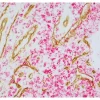 Tonsil (paraffin): ImmPRESS Duet Kit (MP-7724) used to detect mouse anti- CD34 (ImmPACT DAB, brown) and rabbit anti-CD3 (ImmPACT Vector® Red, magenta) antibodies.
