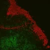 Tonsil: Rabbit Anti-CD3 and Mouse Anti-C11 detected simultaneously with VectaFluor Duet Immunofluorescence Double Labeling Kit, DyLight 488 Anti-Rabbit (green)/DyLight 594 Anti-Mouse (red). Mounted in VECTASHIELD HardSet Mounting Medium with DAPI.