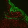 Tonsil: Mouse Anti-Cytokeratin (C11) and Rabbit (monoclonal) Anti-Vimentin detected simultaneously with VectaFluor Duet Immunofluorescence Double Labeling Kit, DyLight 488 Anti-Mouse (green)/DyLight 594 Anti-Rabbit (red). Mounted in VECTASHIELD HardSet