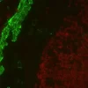 Colon: Mouse Anti-Desmin and Rabbit (monoclonal) Anti-CD3 detected simultaneously with VectaFluor Duet Immunofluorescence Double Labeling Kit, DyLight 488 Anti-Mouse (green)/DyLight 594 Anti-Rabbit (red). Mounted in VECTASHIELD HardSet Mounting Medium.