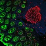 Colon: Mouse Anti-Cytokeratin (Ae1/Ae3) And Rabbit Anti-Ki67 Detected Simultaneously With Vectafluor Duet Immunofluorescence Double Labeling Kit, Dylight 488 Anti-Mouse (Green)/Dylight 594 Anti-Rabbit (Red). Mounted In Vectashield Hardset Mounting Mediu