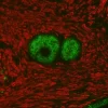 Prostate: Rabbit Anti-PSA MAb and Mouse Anti-Smooth Muscle Actin detected simultaneously with VectaFluor Duet Immunofluorescence Double Labeling Kit, DyLight 488 Anti-Rabbit (green)/DyLight 594 Anti-Mouse (red). Mounted in VECTASHIELD HardSet Mounting M