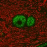 Prostate: Rabbit Anti-Psa Mab And Mouse Anti-Smooth Muscle Actin Detected Simultaneously With Vectafluor Duet Immunofluorescence Double Labeling Kit, Dylight 488 Anti-Rabbit (Green)/Dylight 594 Anti-Mouse (Red). Mounted In Vectashield Hardset Mounting M