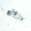 Colon: PGP 9.5 (m, VP-P983), ImmPRESS Anti-Mouse Ig Kit, ImmPACT SG (blue-gray) substrate.