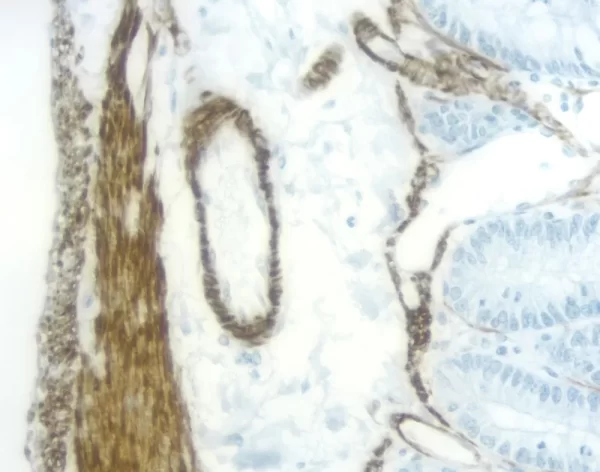 Rat Intestine: Desmin (M), Immpress Anti-Mouse Ig Kit (Rat Adsorbed), Dab (Brown) Substrate Kit. Hematoxylin Qs (Blue) Counterstain.