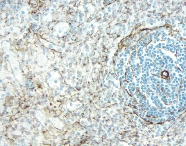 Rat Spleen: Desmin (M), Immpress Anti-Mouse Ig Kit (Rat Adsorbed), Dab (Brown) Substrate Kit. Hematoxylin Qs (Blue) Counterstain.