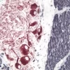 Small Bowel (double label): Peripherin (m), ImmPRESS Anti-Mouse Ig Kit, Vector NovaRED (red) substrate. Desmin (m), ImmPRESS Anti-Mouse Ig Kit, DAB/Ni (black) substrate.