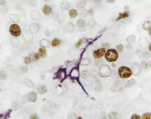 Dab Substrate Kit, Peroxidase (Hrp), With Nickel, (3,3'-Diaminobenzidine)