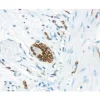 Small bowel: CD56 (m), VECTASTAIN Universal Elite ABC Kit, ImmPACT DAB (brown) substrate. Hematoxylin QS counterstsain (blue).